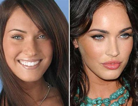 megan fox boobjob|Megan Fox Wanted 'the Biggest Boobs' After Surgery .